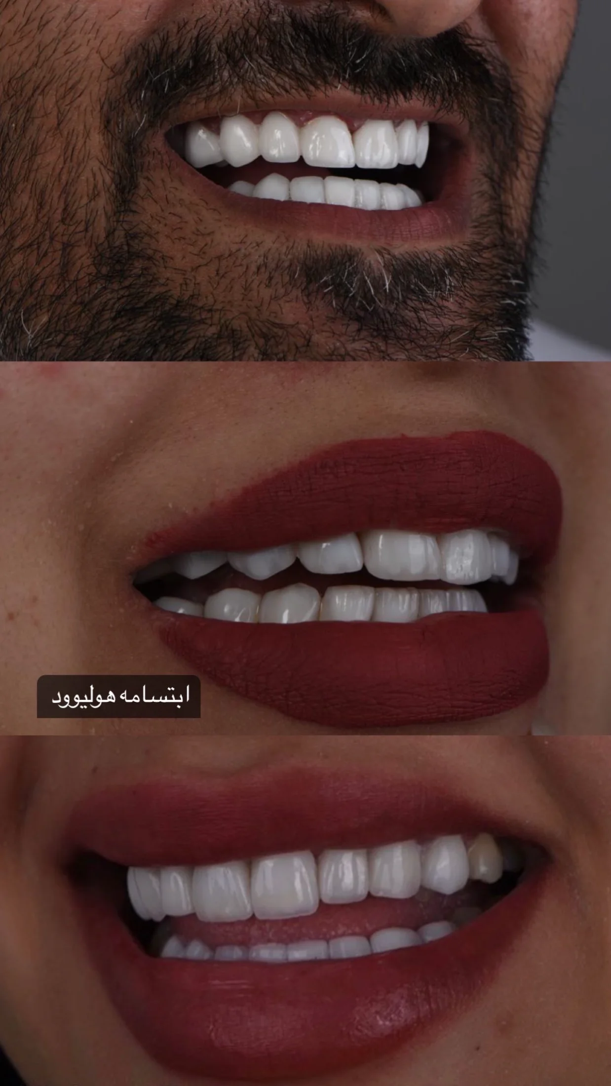 هوليوود سمايل